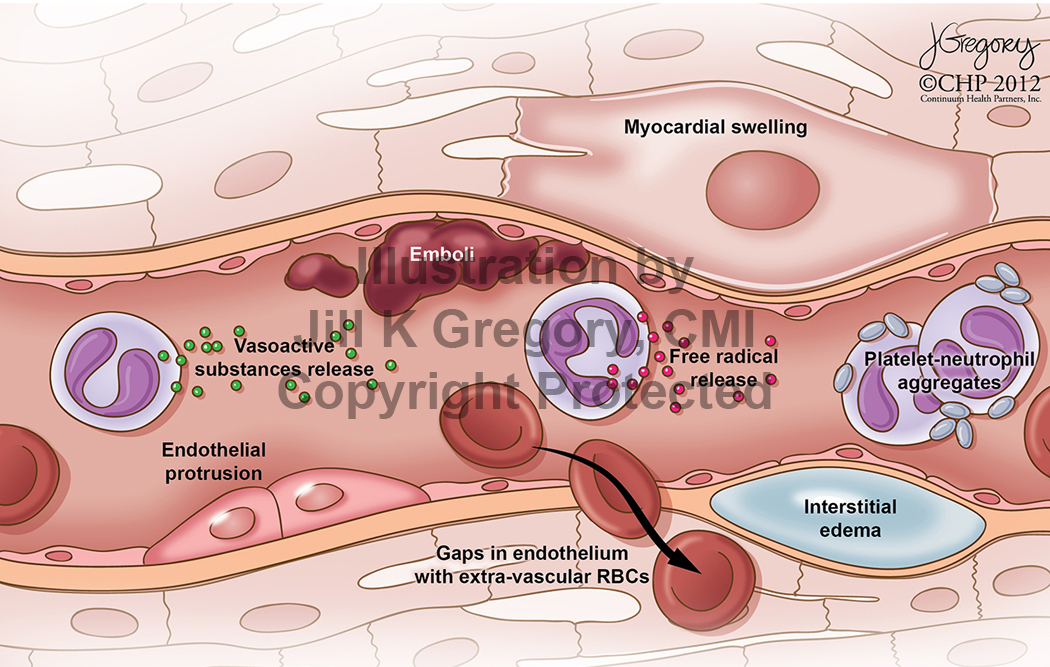 Vascular Pathologies