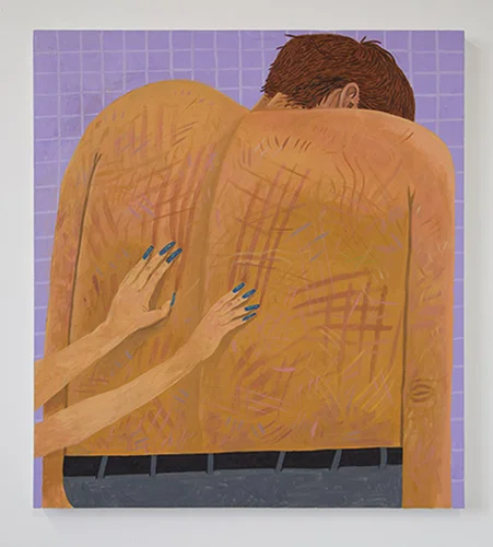 5_Back_Scratch_Fever_2015_HR.jpg