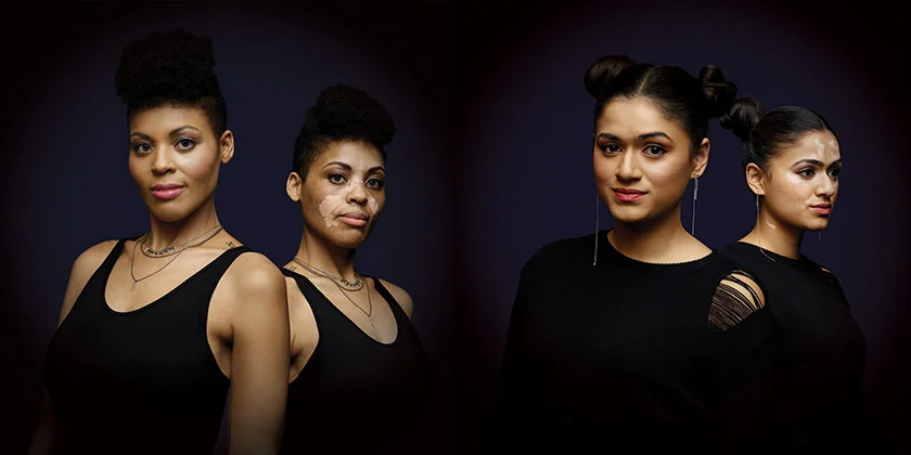 Before and After Shots from a Dermablend Campaign