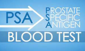 The Pros And Cons of PSA Screening
