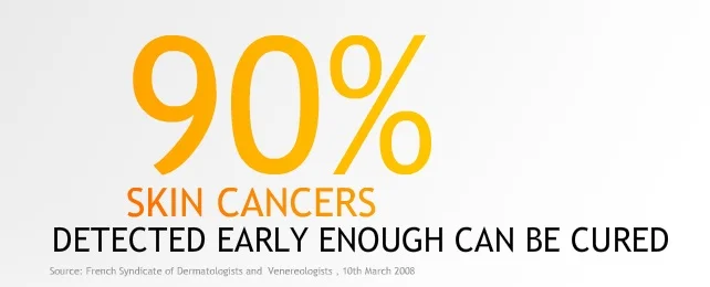 Skin Cancer Awareness Month: How to detect and prevent this deadly disease