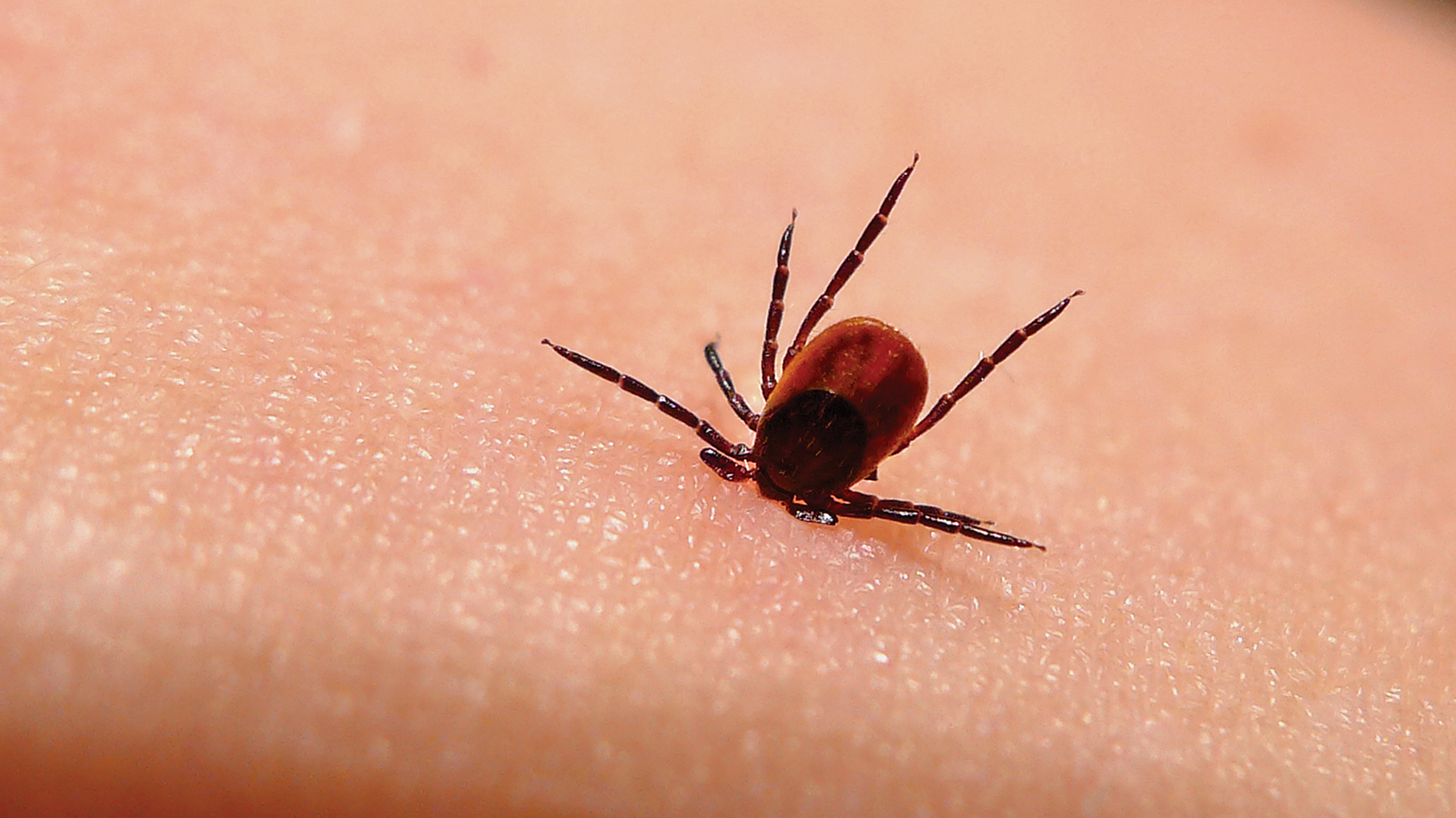 Lyme disease: Causes and treatments