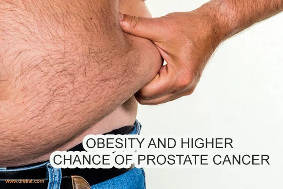 Obesity could make prostate cancer more aggressive, study says