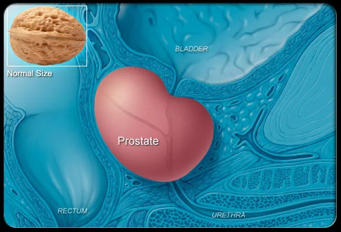Enlarged Prostate: What is it? What are the treatments?