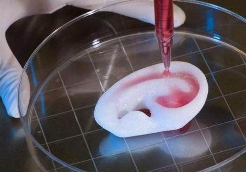 3–D Printed Organs: Future of Healthcare?