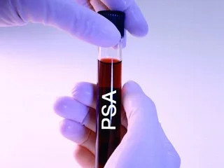 psatestforprostatecancer.jpg