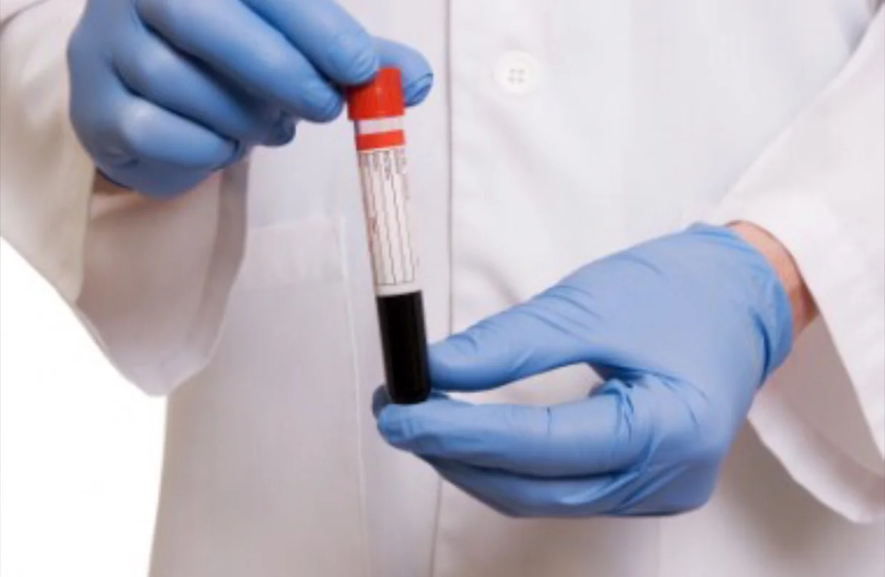 Optimizing PSA Testing
