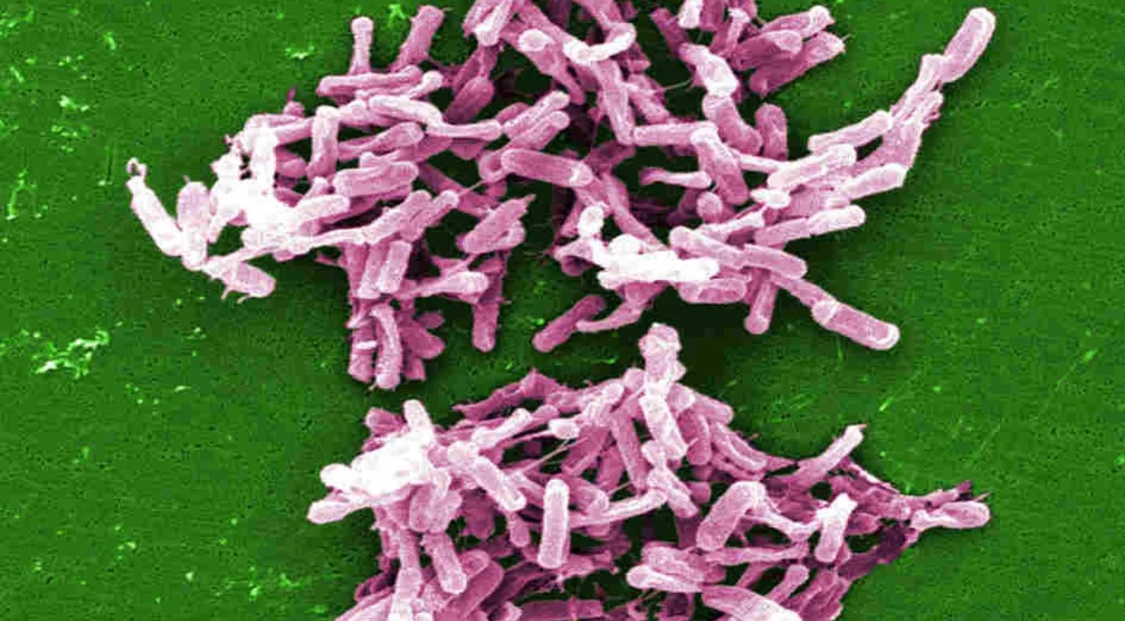 Study shows Americans have fewer types of gut bacteria than less developed nations