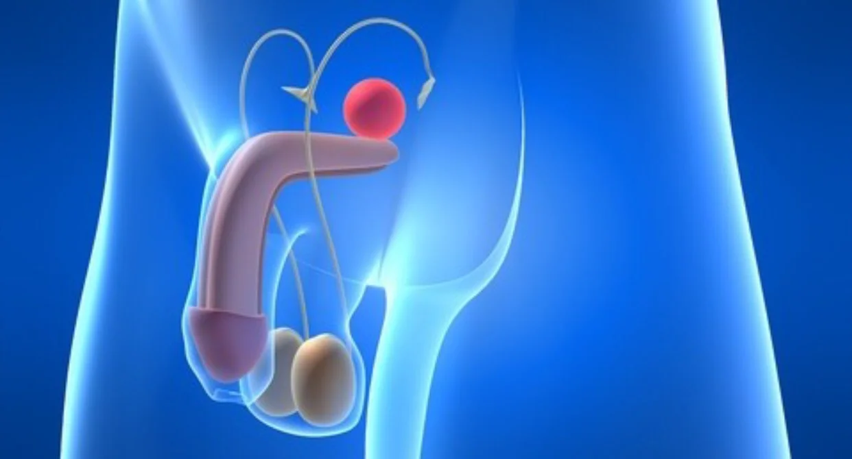 What is a TURP?