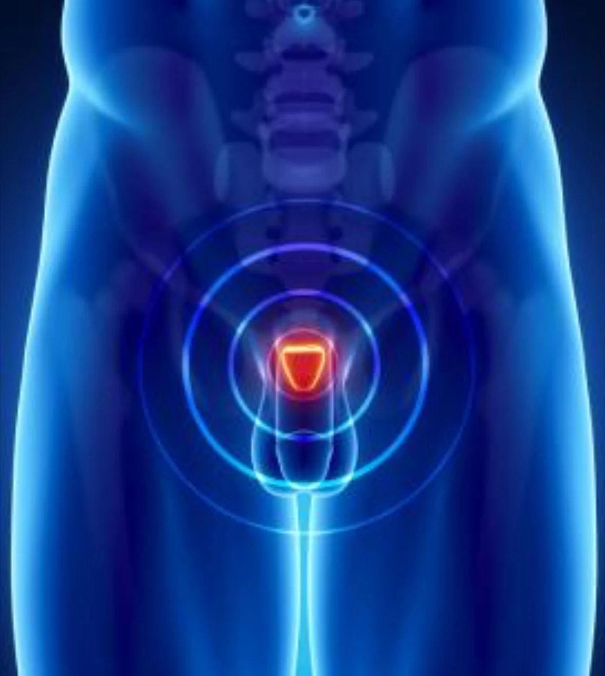 Use of post-surgical radiation for prostate cancer patients at risk of recurrence is declining, despite known benefit