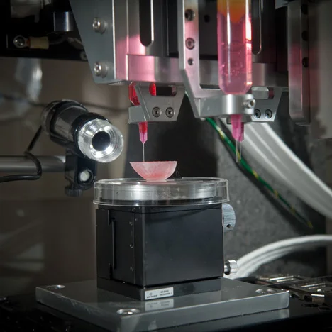 Child, First Patient to be Cured of Illness Using 3D-Printed Biodegradable Implant