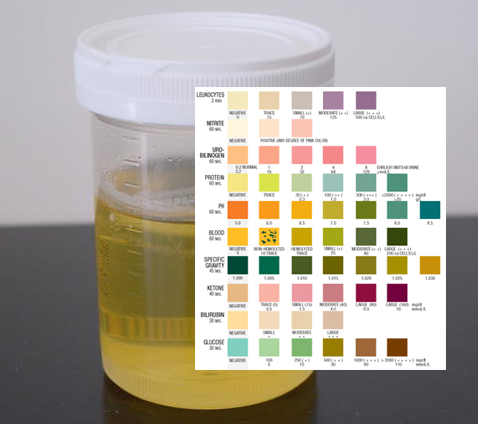UTI’s getting harder to treat