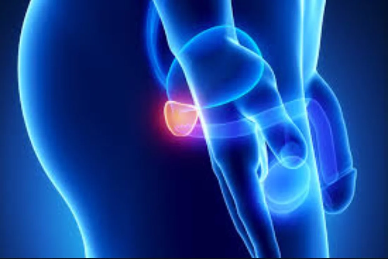 Prostate cancer treatment options by stage