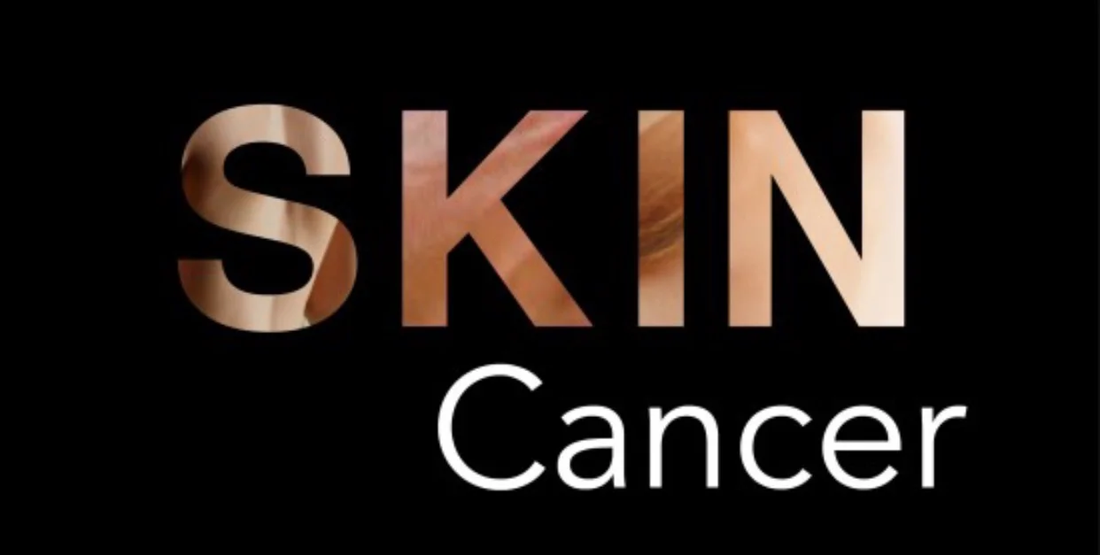 Stages of melanoma explained