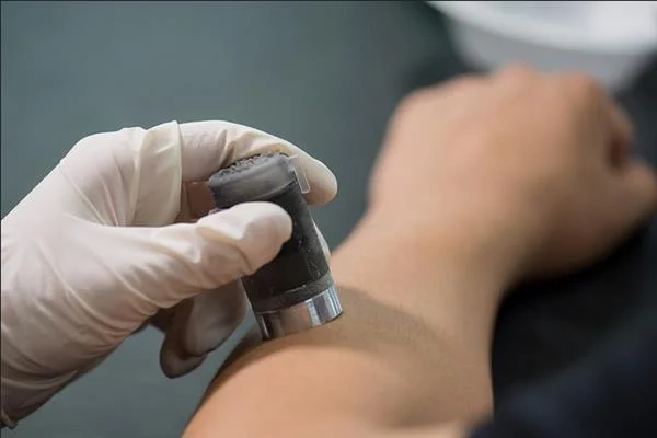 Hate Needles? Potential 3-D Printed Device May Be Alternative