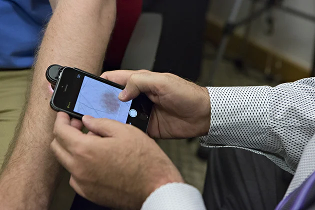 Diagnosing Skin Cancer via iPhone Apps