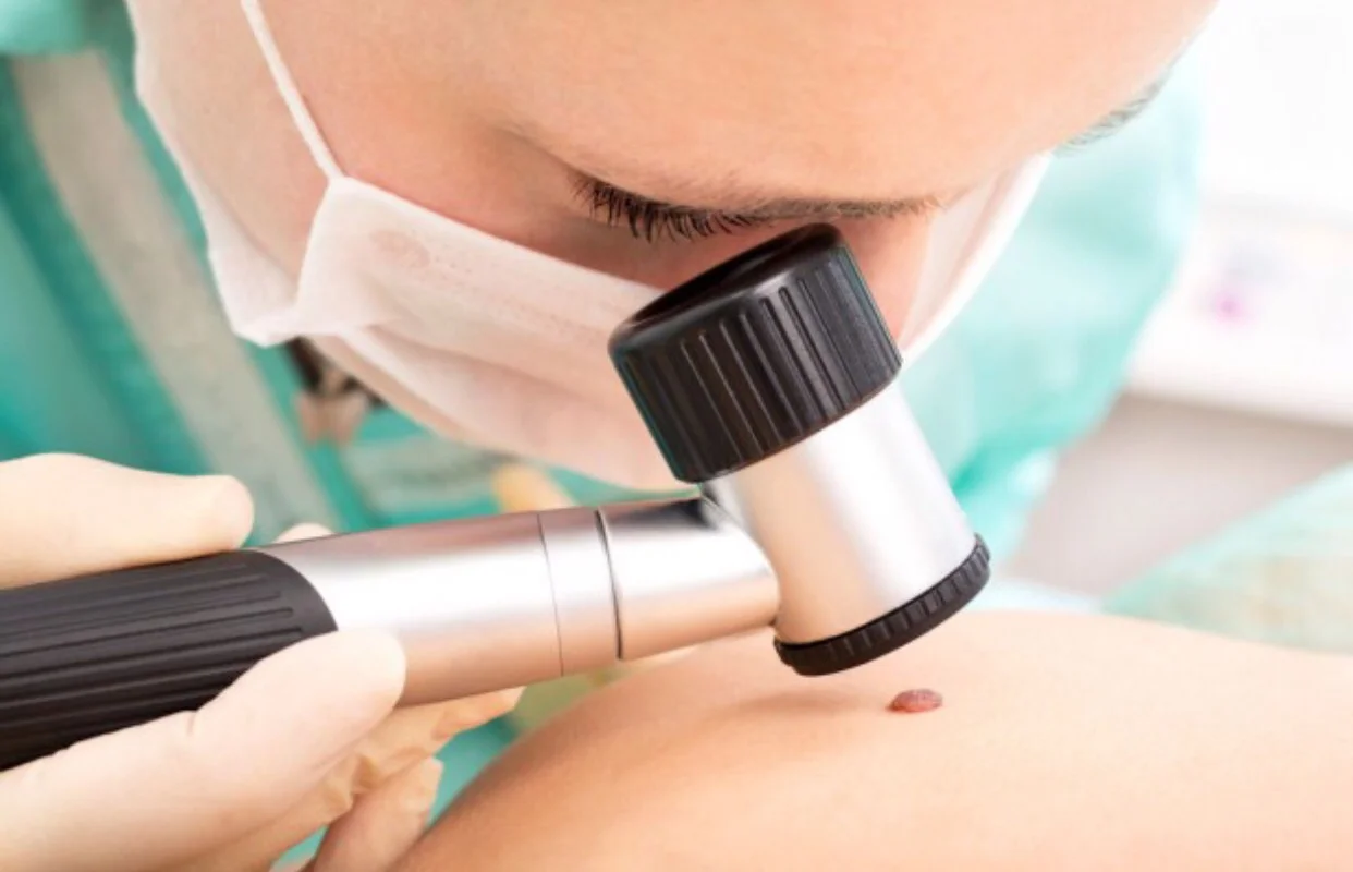 Experimental treatments for metastatic melanoma