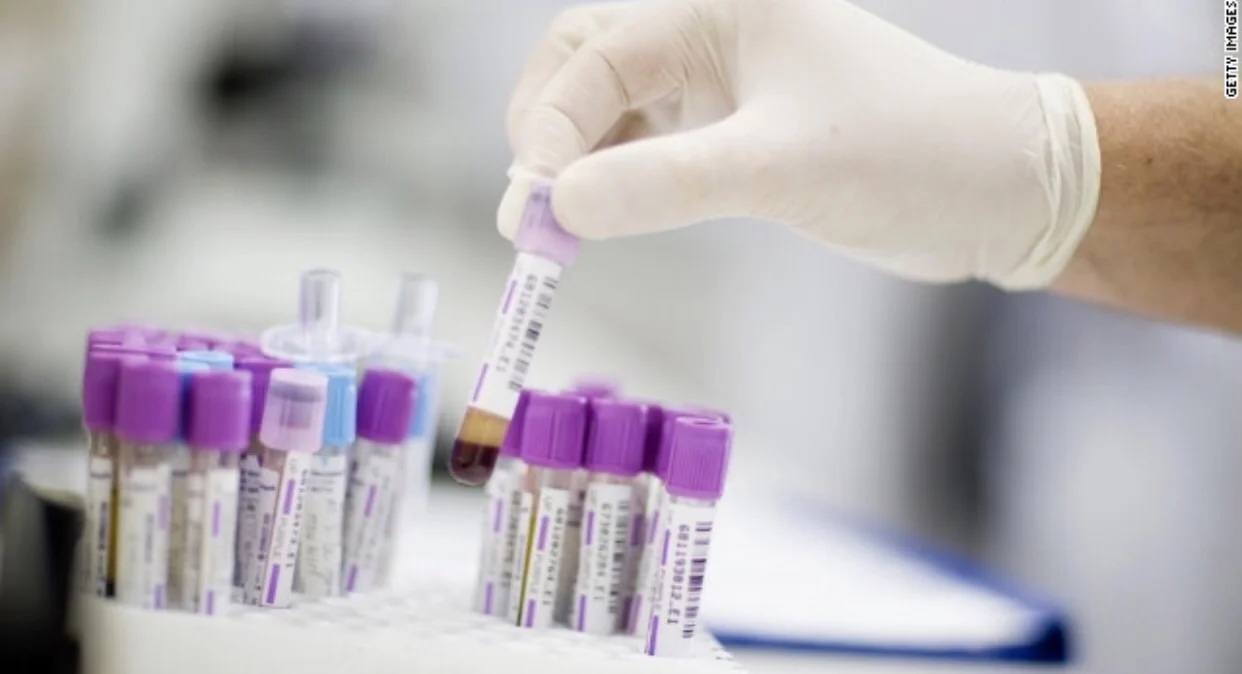 New studies suggest better Prostate cancer screening methods