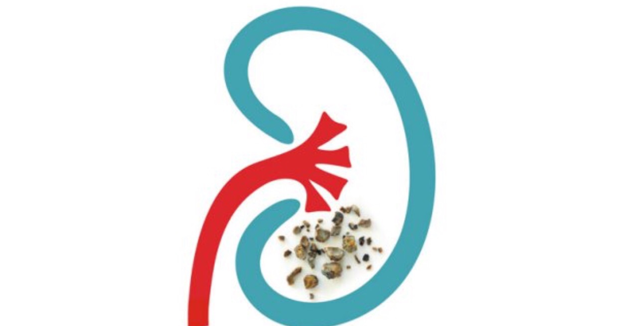 How Lupus Affects the Kidneys