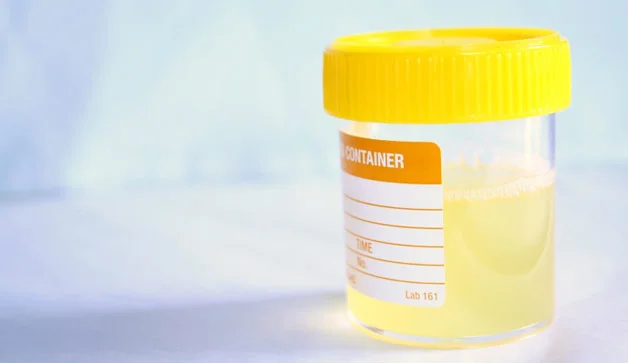 Chronic UTI symptoms could mean bladder cancer