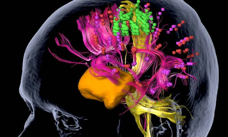 braintumors.jpg
