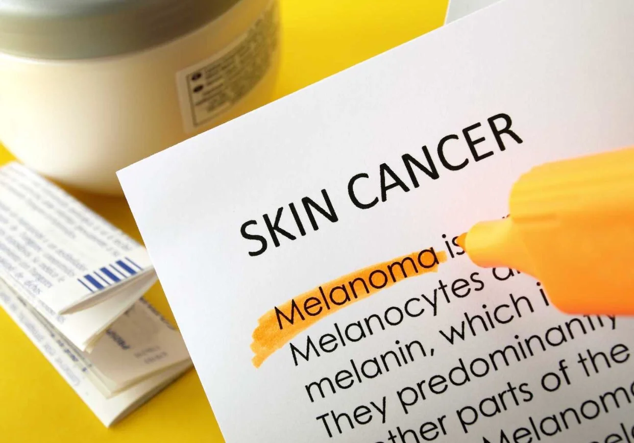 The ABC's of Skin Cancer