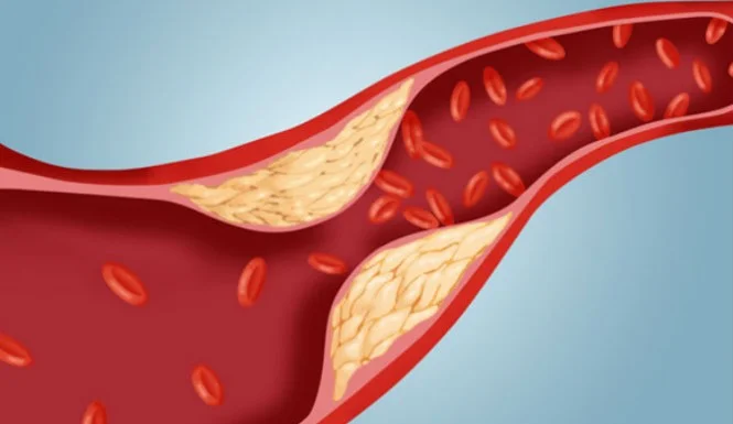 Cancer Treatments Raise Risk of Blood Clots