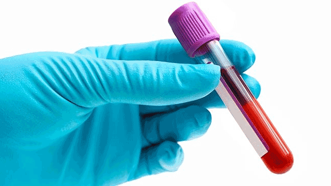 What to expect after pancreatic cancer diagnosis