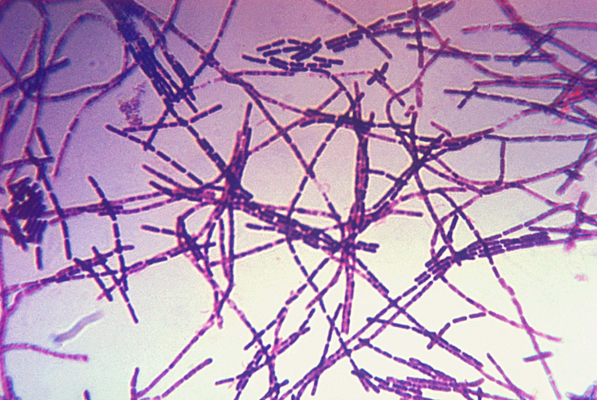 U.S. Military Accidentally Sends Live Anthrax