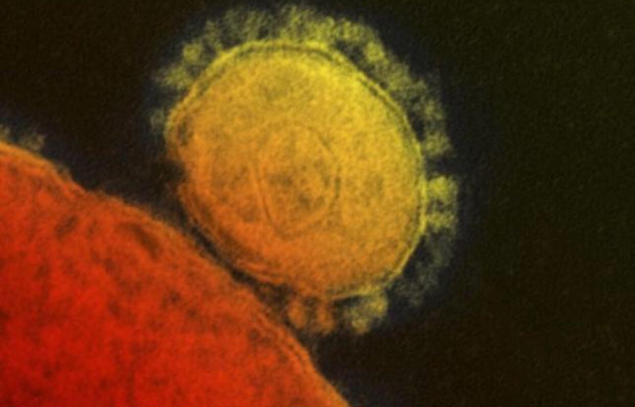 South Korea Reports 2 Deaths from Mers