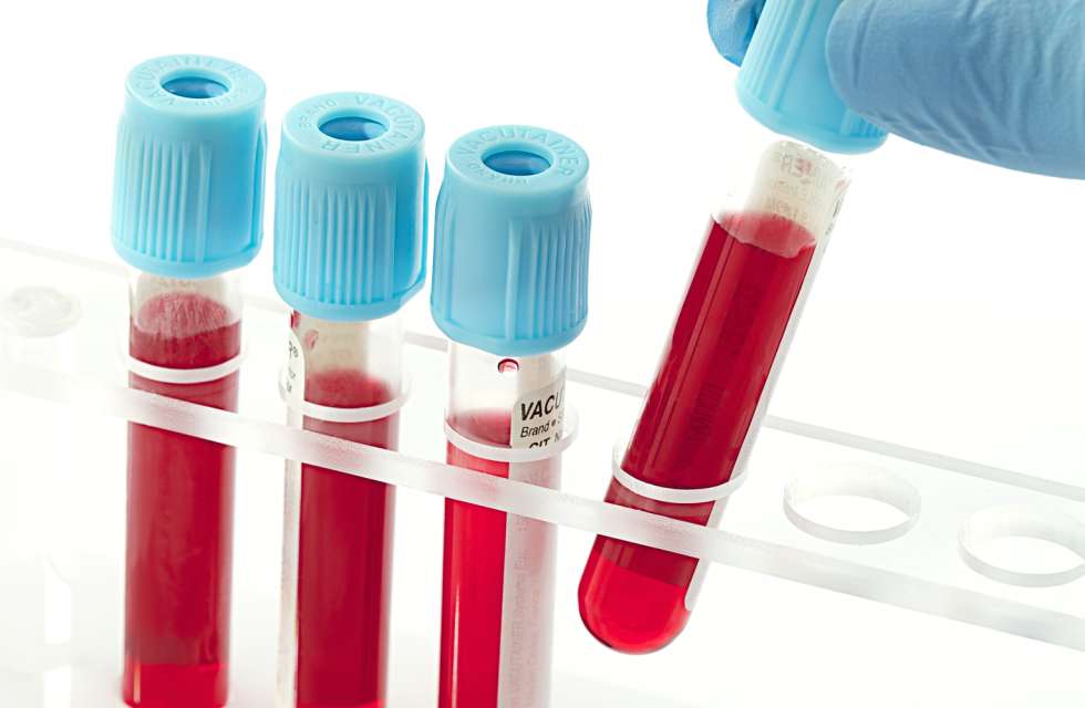 VirScan Blood Test Reveals Entire Viral History