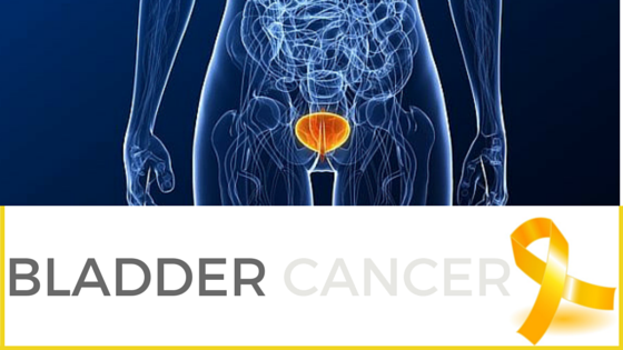 What You Need to Know About Bladder Cancer