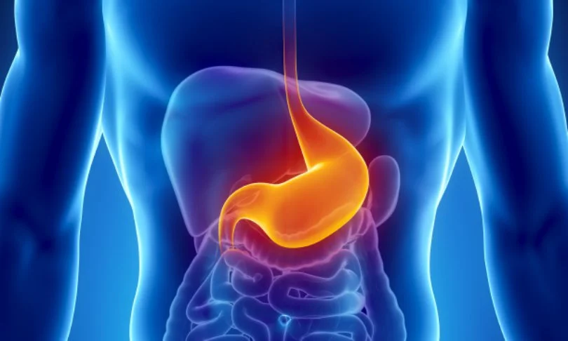 What is stomach cancer?