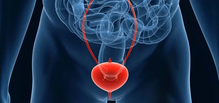What is Bladder Outlet Obstruction?
