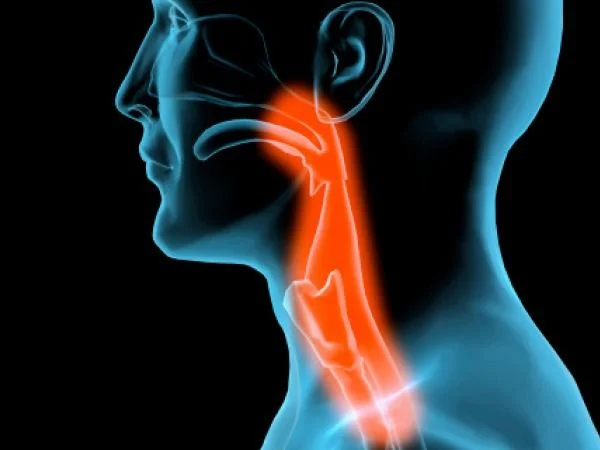 What is laryngeal cancer?
