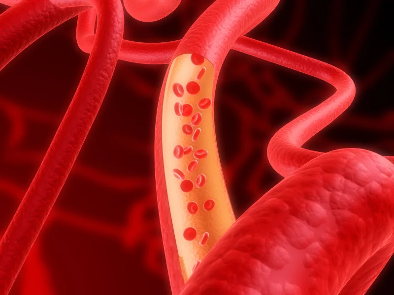 Are you at risk for a blood clotting disorder?