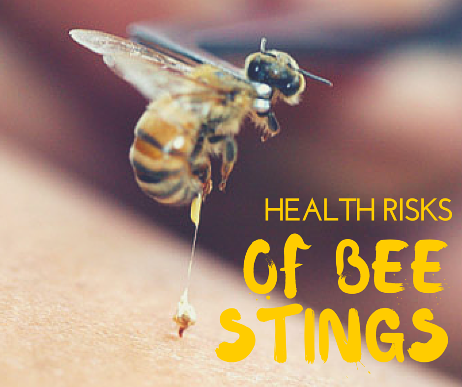 Summer Health: Preventing Bee Stings 