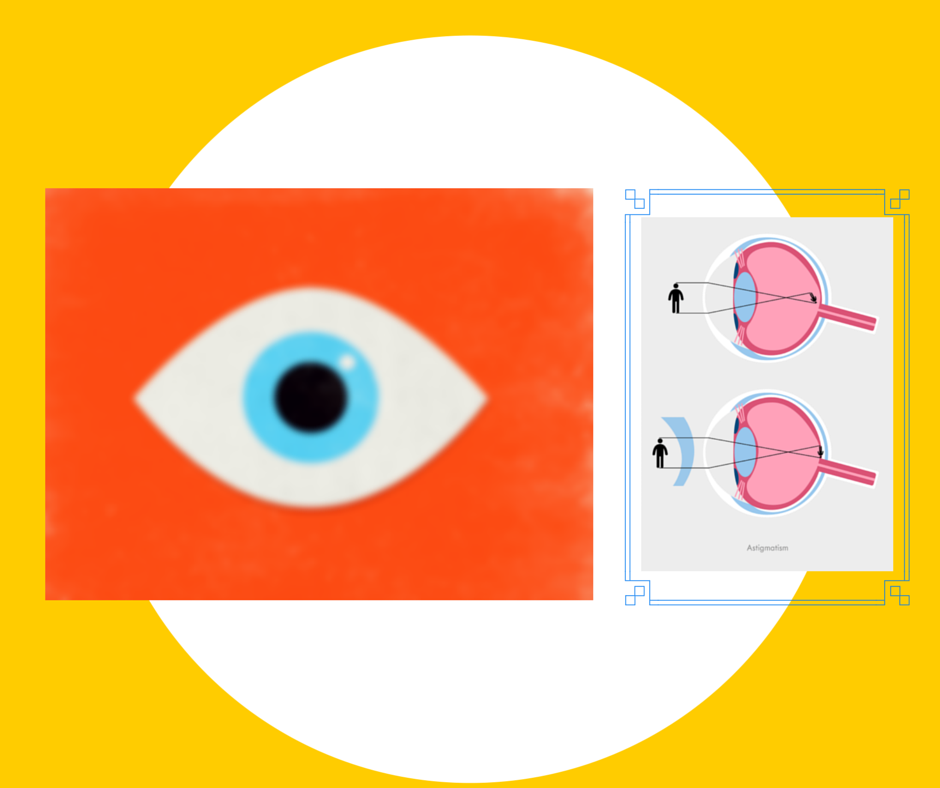 Eye Health and Diagnosing Astigmatism