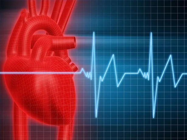 What is congestive heart failure?