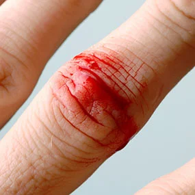 What is hepatitis C?