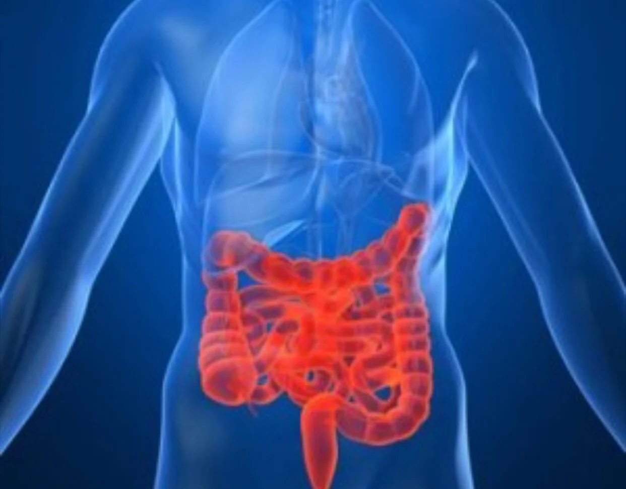What is inflammatory bowel disease?