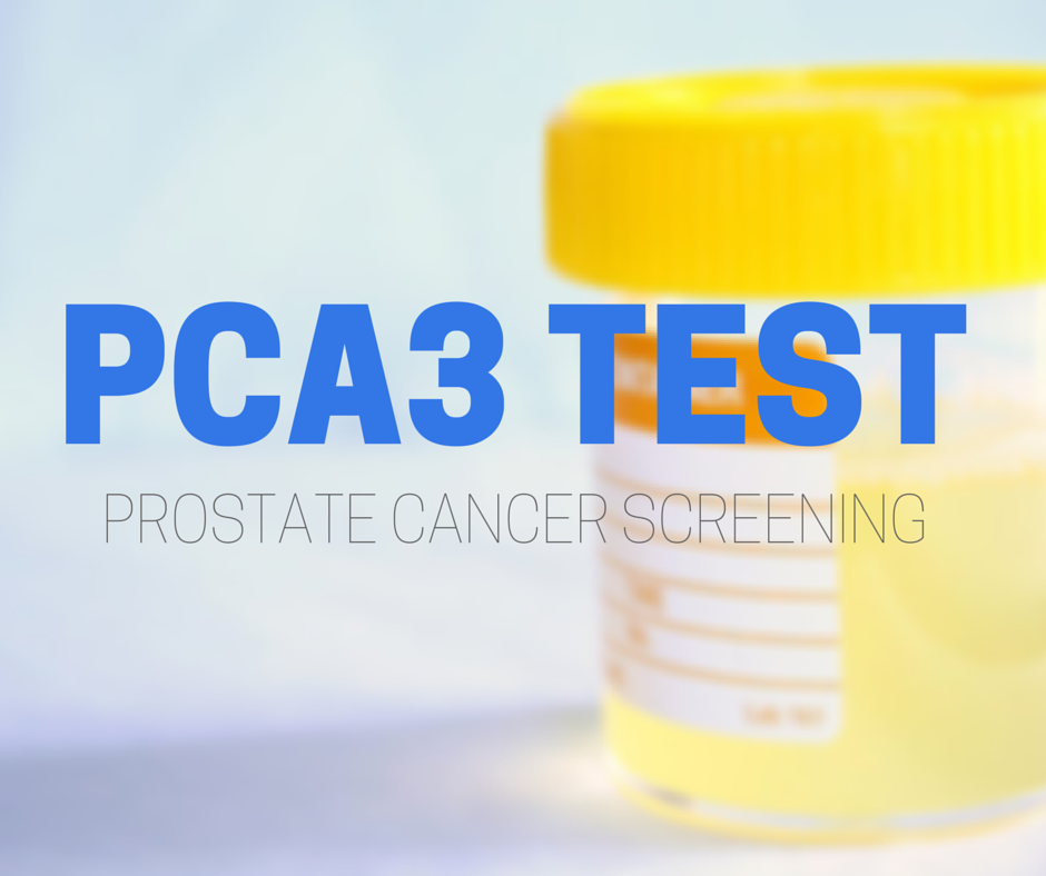 PCA3 test for prostate cancer