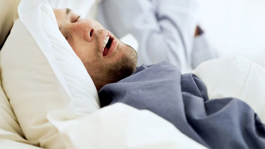 Do You Have Sleep Apnea?