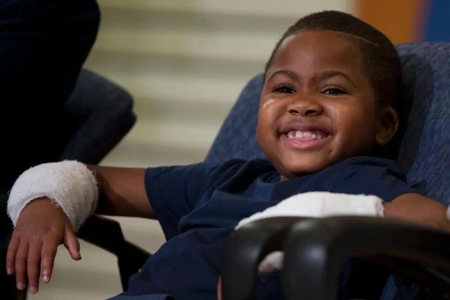 First pediatric double hand transplant performed on Baltimore boy