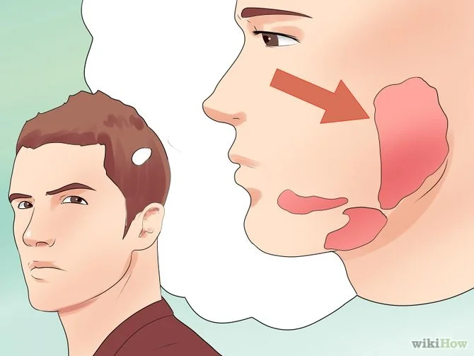 Do You Have the Mumps?