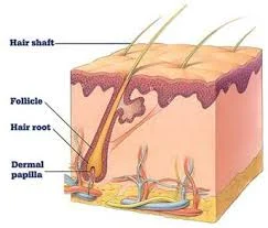 Female Pattern Baldness
