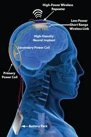 What Is Pick’s Disease?