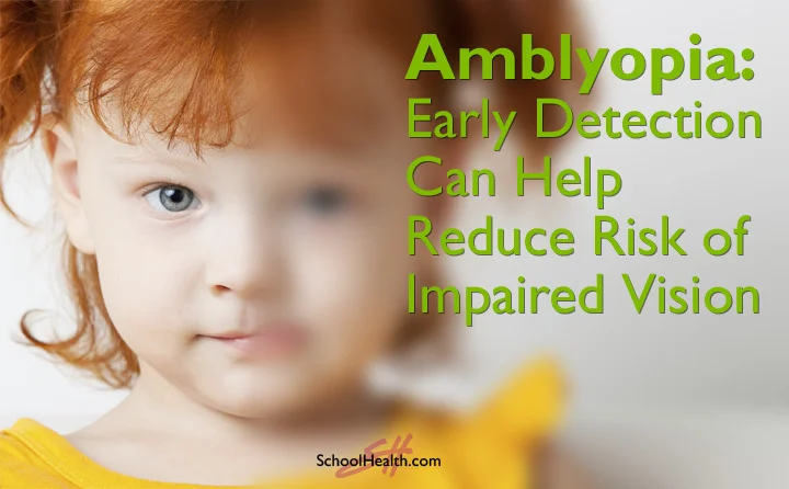 What is Amblyopia?