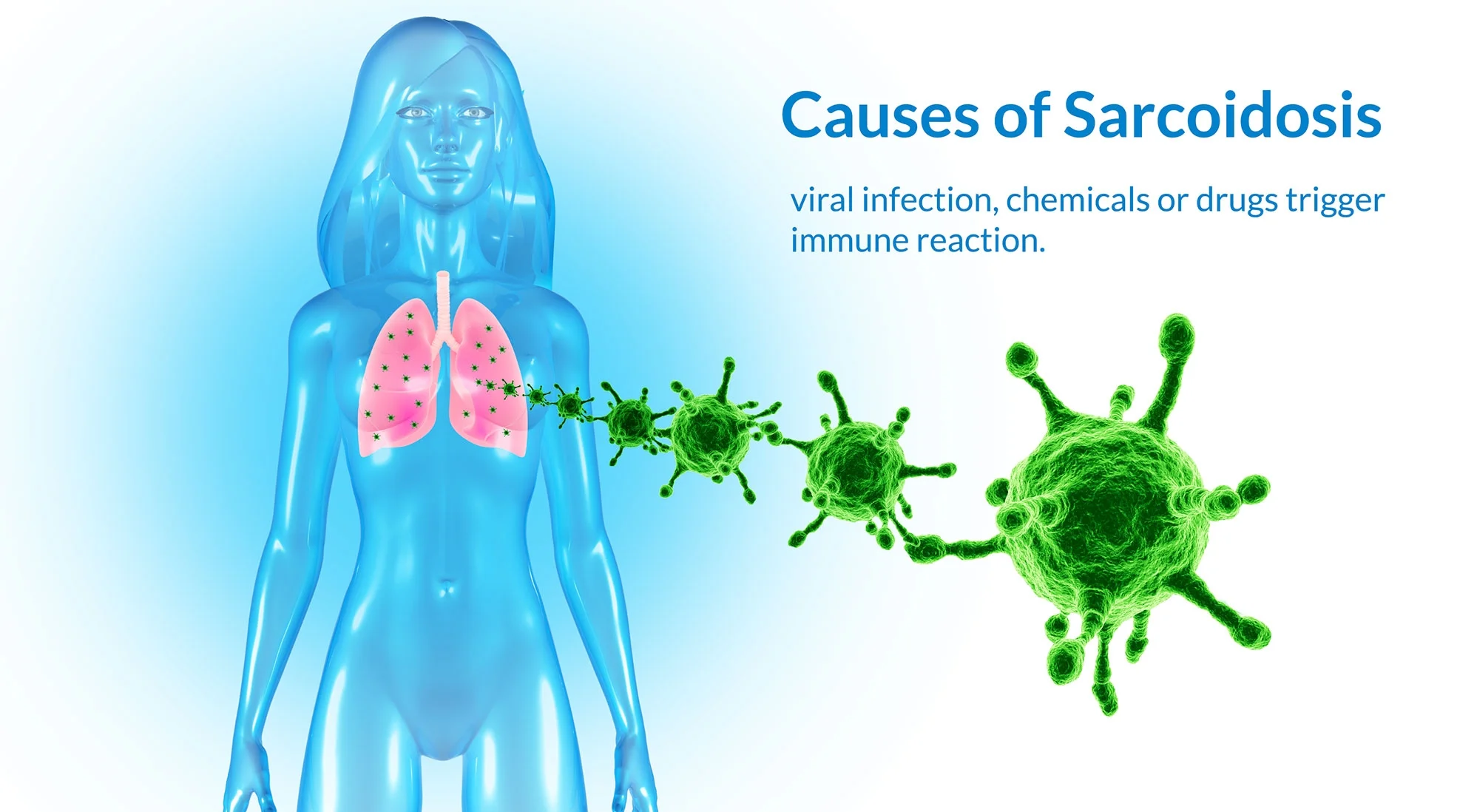 What is sarcoidosis?