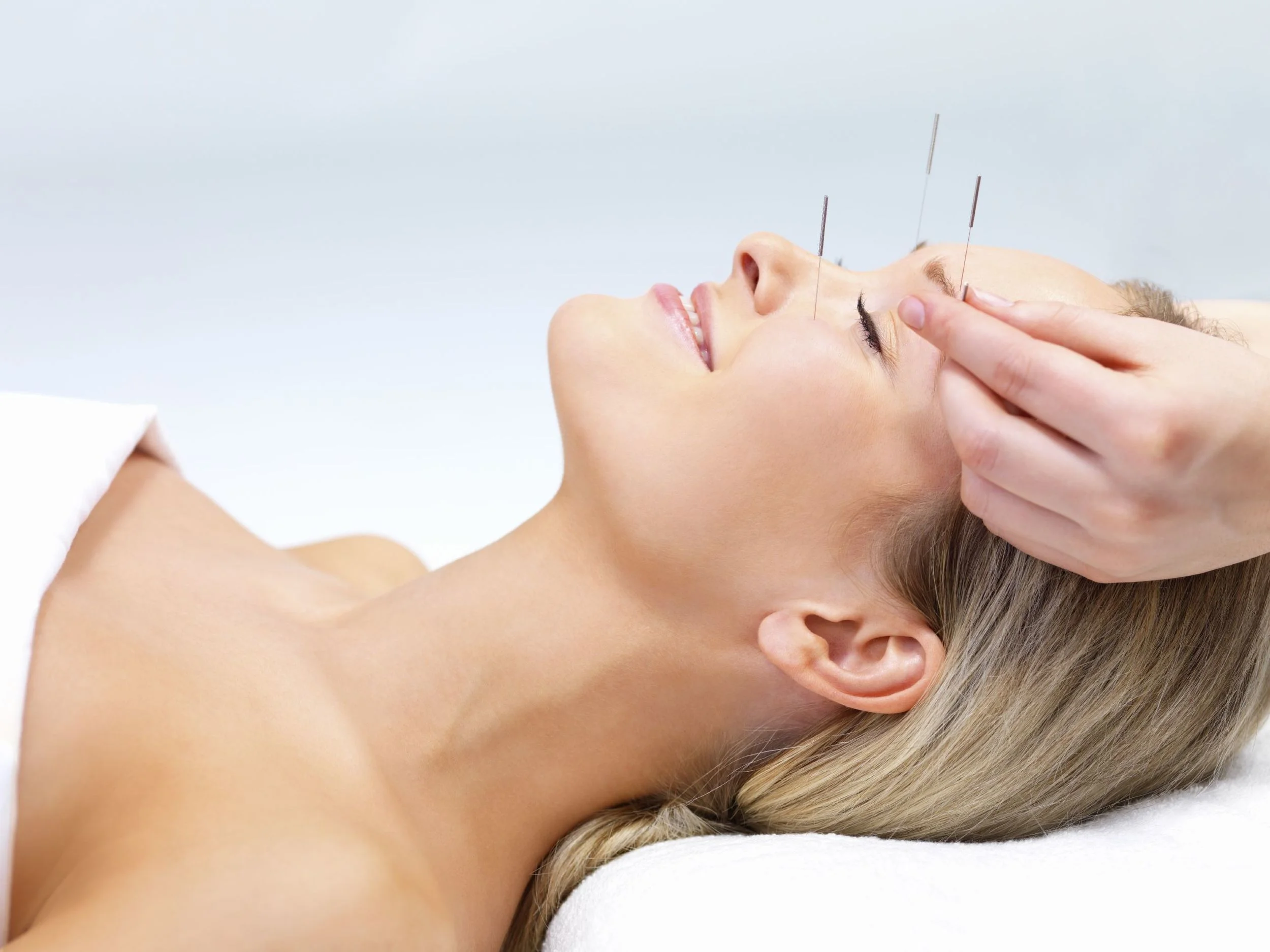 Acupuncture Treats Modern Ailments